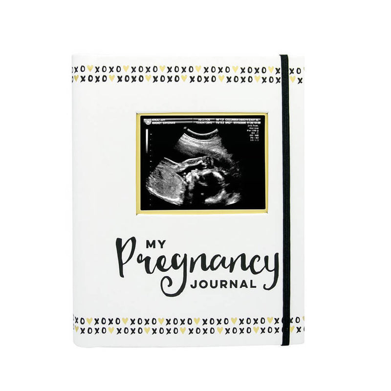 The Pearhead Pregnancy Journal Book by Pearhead features a black-and-white ultrasound photo on the cover, a black elastic band, and decorative "XOXO" patterns along the top and bottom edges.